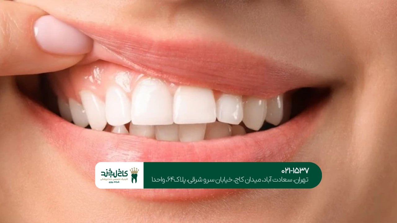 متخصص زیبایی لبخند