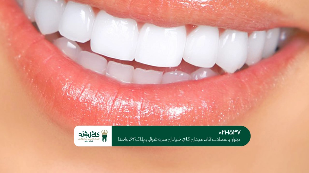مرکز تخصصی کامپوزیت دندان