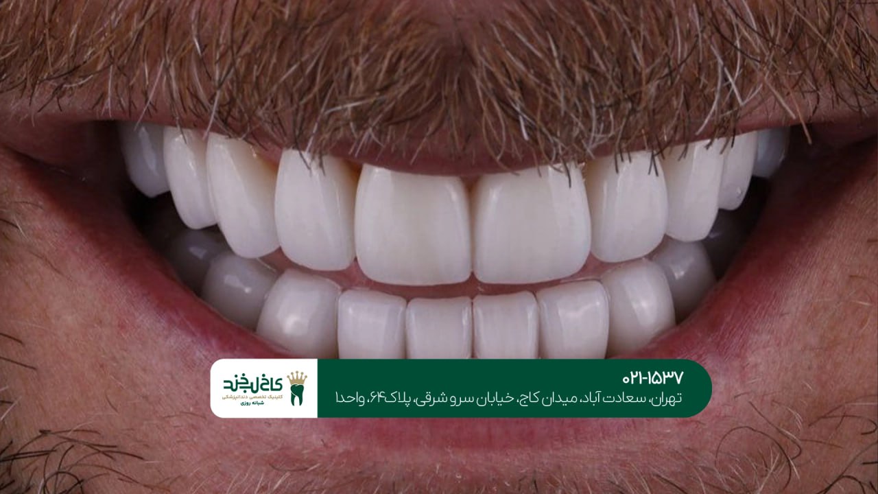 بهترین دندان پزشک زیبایی