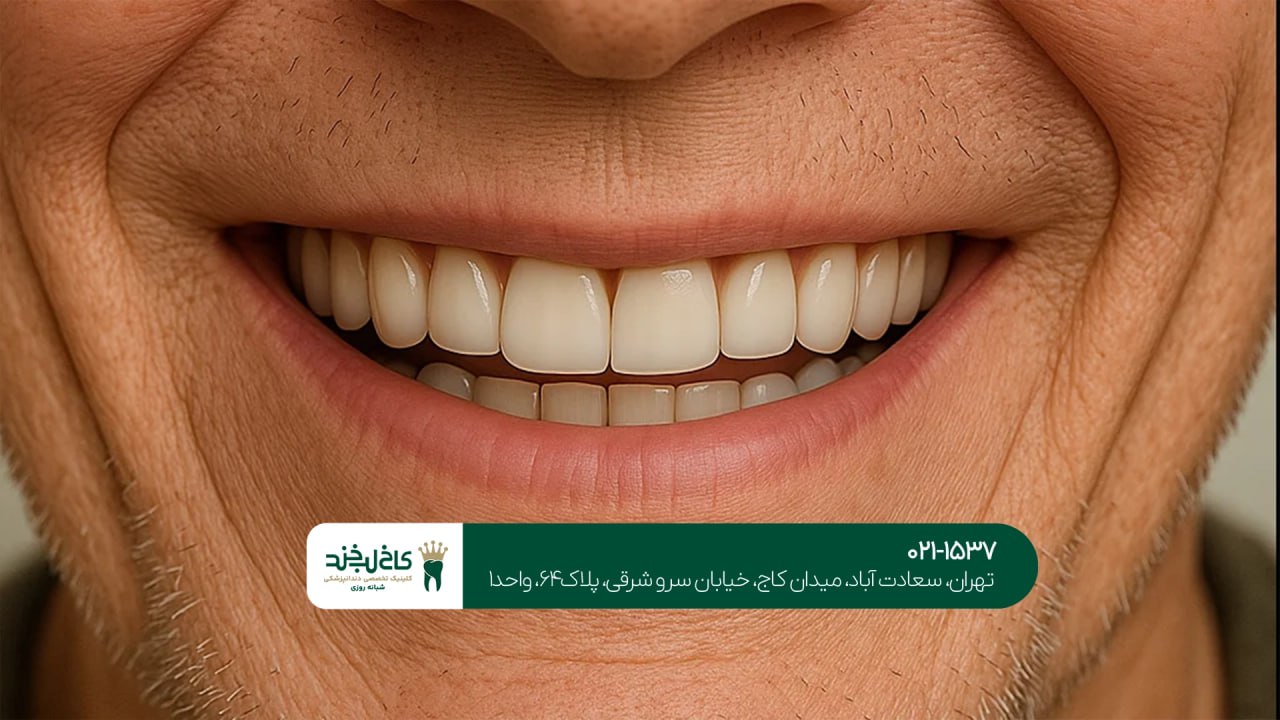 مراحل طراحی لبخند دیجیتال