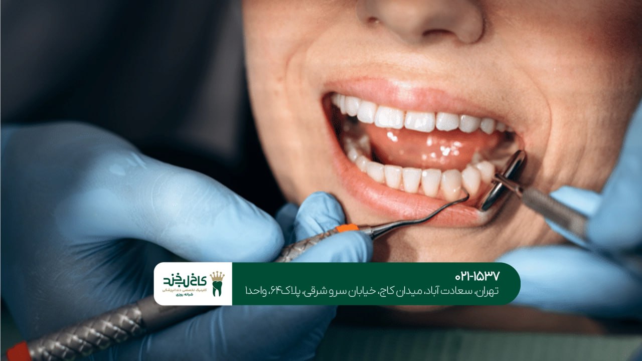 جرمگیری تخصصی دندان