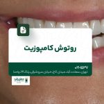 روتوش کامپوزیت