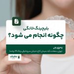 بلیچینگ خانگی چگونه انجام می شود؟