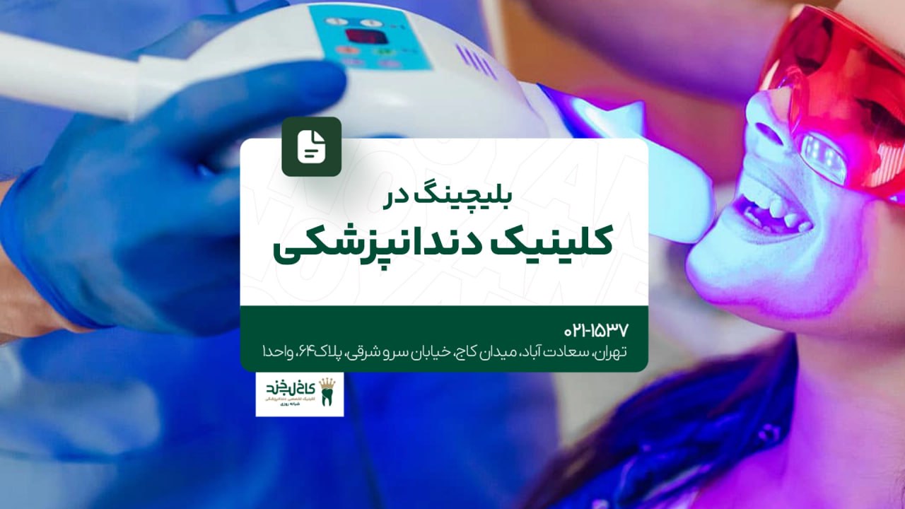 بلیچینگ در کلینیک دندانپزشکی