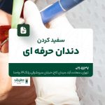 سفید کردن دندان حرفهای