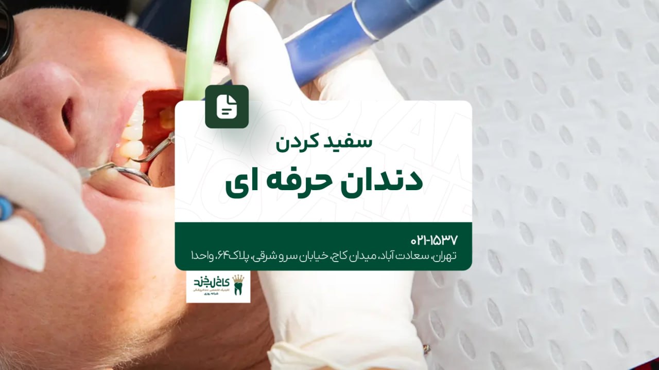 سفید کردن دندان حرفهای