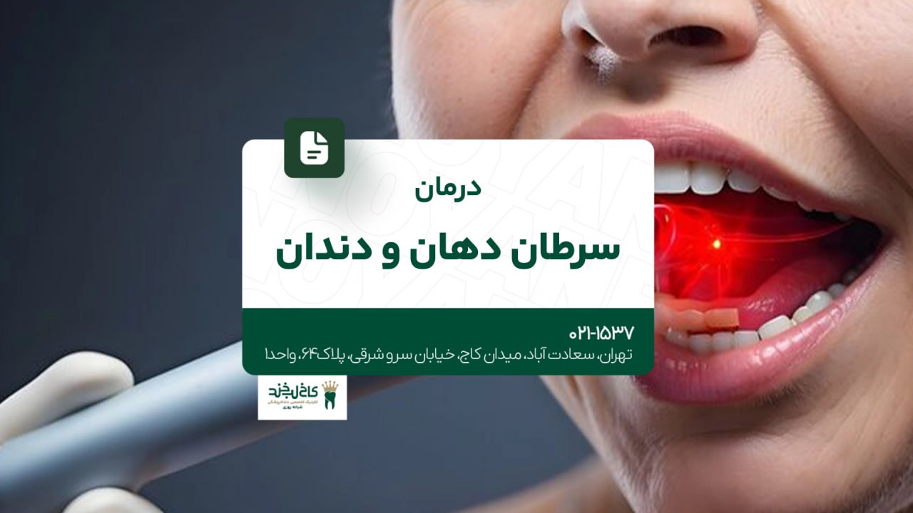 درمان سرطان دهان و دندان