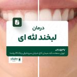 درمان لبخند لثهای