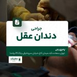 جراحی دندان عقل