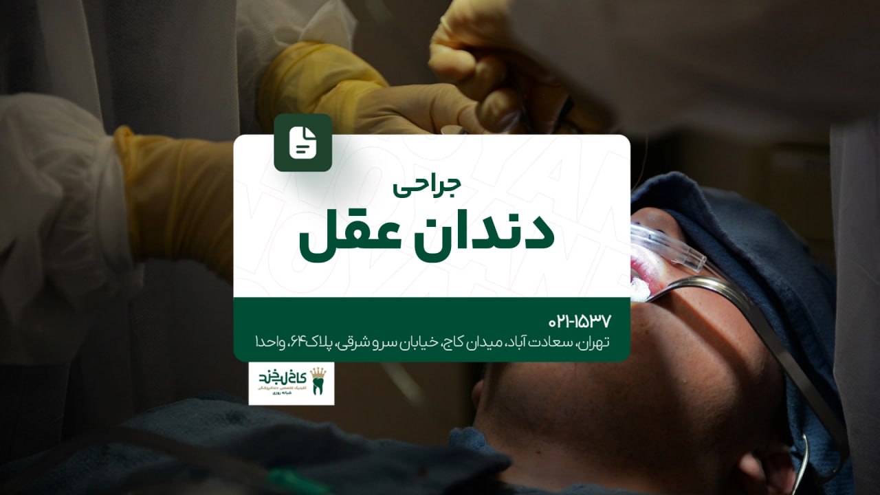 جراحی دندان عقل