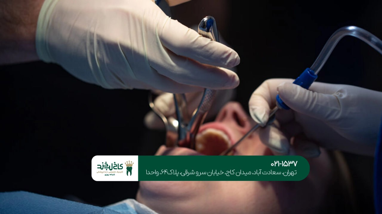 جراحی دندان عقل اقساطی در تهران جراحی دندان عقل اقساطی در تهران