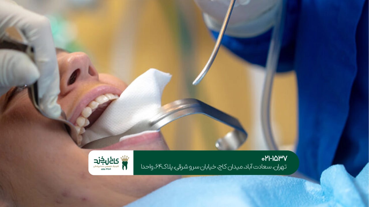 جراحی دندان عقل اقساطی در تهران جراحی دندان عقل اقساطی در تهران