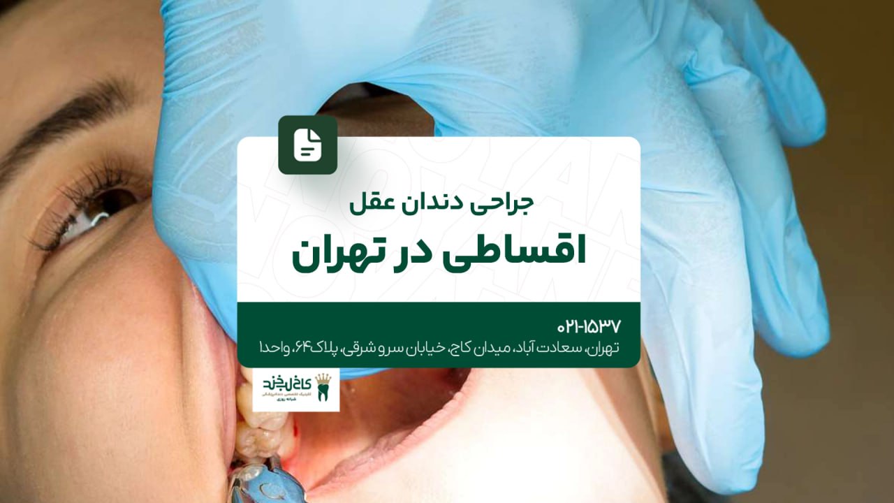 جراحی دندان عقل اقساطی در تهران جراحی دندان عقل اقساطی در تهران