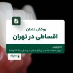 روکش دندان اقساطی در تهران
