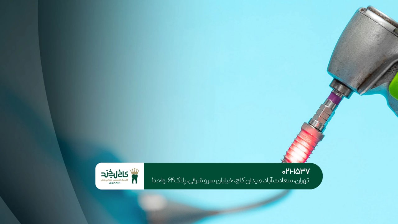 کاشت دندان با لیزر در شمال تهران کاشت دندان با لیزر در شمال تهران