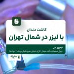 کاشت دندان با لیزر در شمال تهران