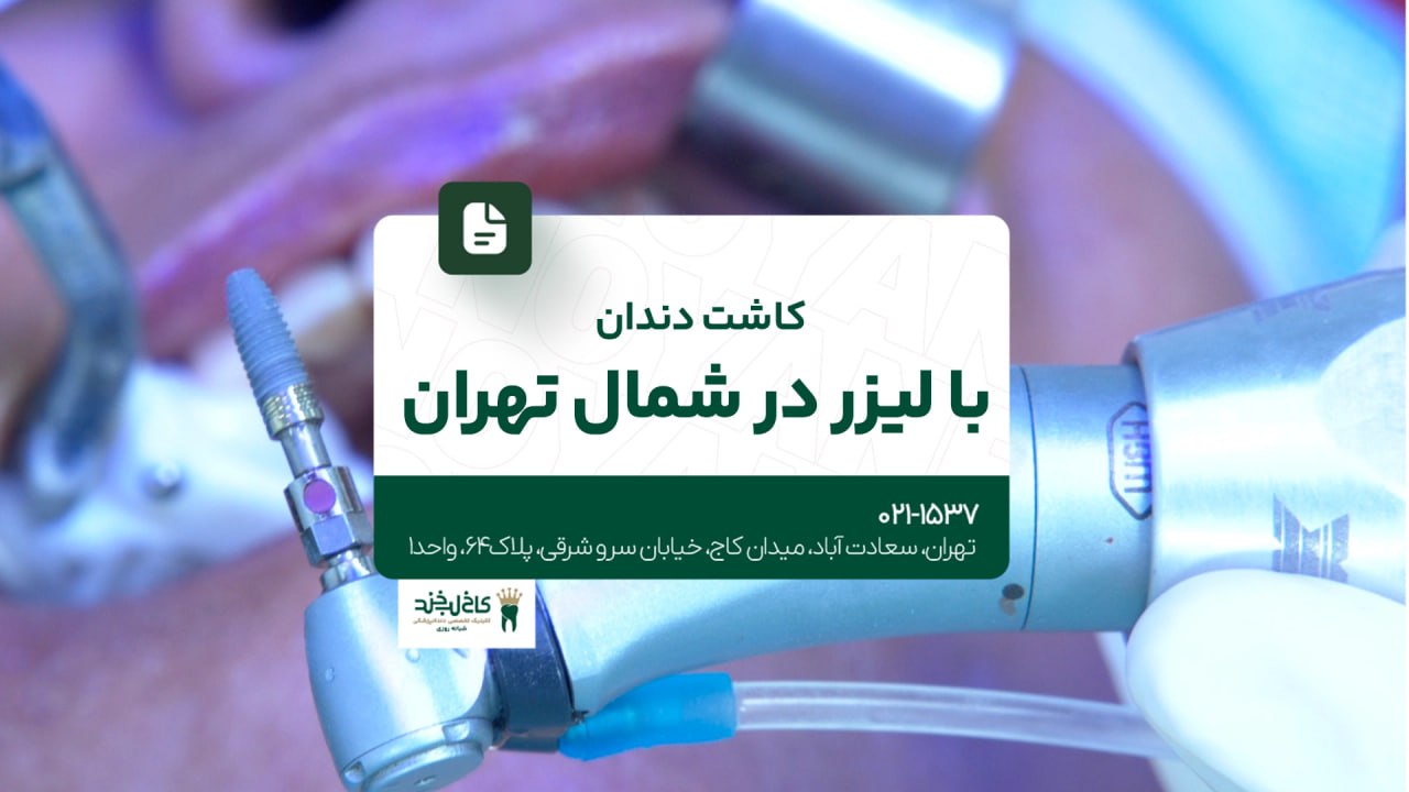 کاشت دندان با لیزر در شمال تهران کاشت دندان با لیزر در شمال تهران