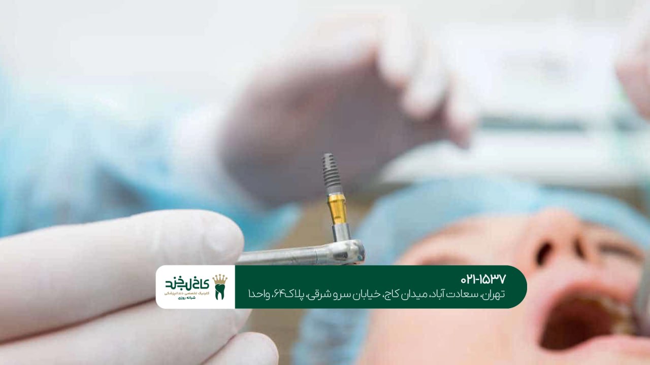 کلینیک تخصصی ایمپلنت در الهیه کلینیک تخصصی ایمپلنت در الهیه
