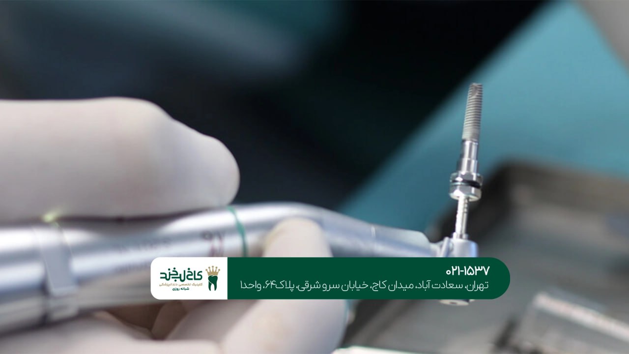 کلینیک تخصصی ایمپلنت در الهیه کلینیک تخصصی ایمپلنت در الهیه