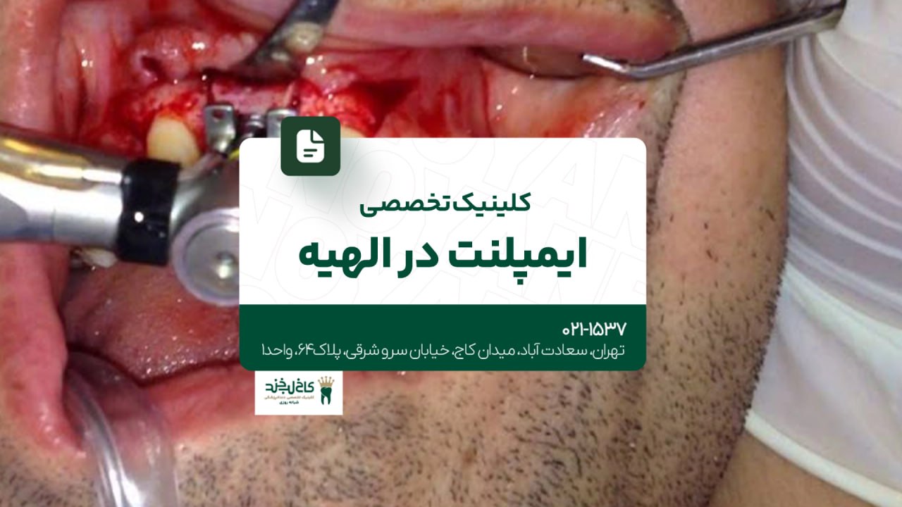 کلینیک تخصصی ایمپلنت در الهیه کلینیک تخصصی ایمپلنت در الهیه