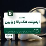 خدمات ایمپلنت فک بالا و پایین