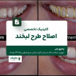 کلینیک تخصصی اصلاح طرح لبخند