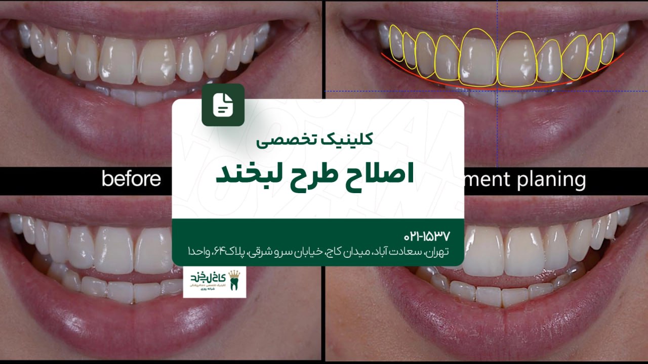 کلینیک تخصصی اصلاح طرح لبخند کلینیک تخصصی اصلاح طرح لبخند