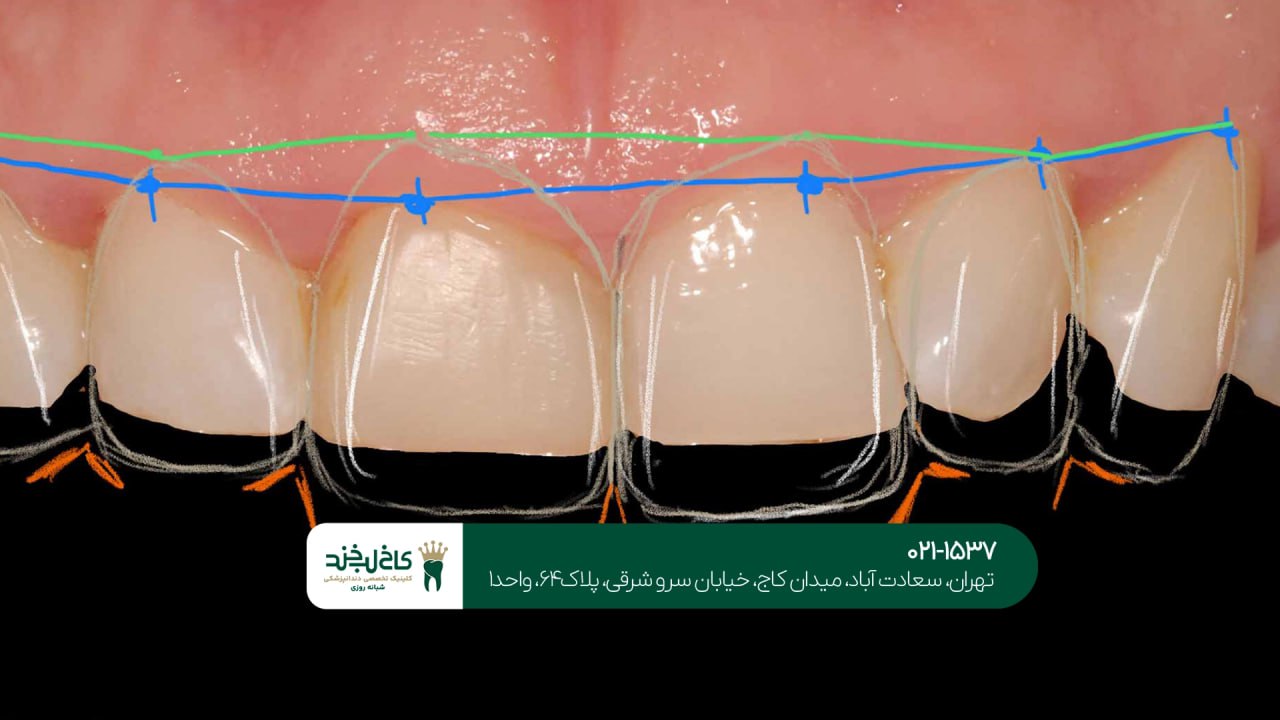 کلینیک تخصصی اصلاح طرح لبخند کلینیک تخصصی اصلاح طرح لبخند