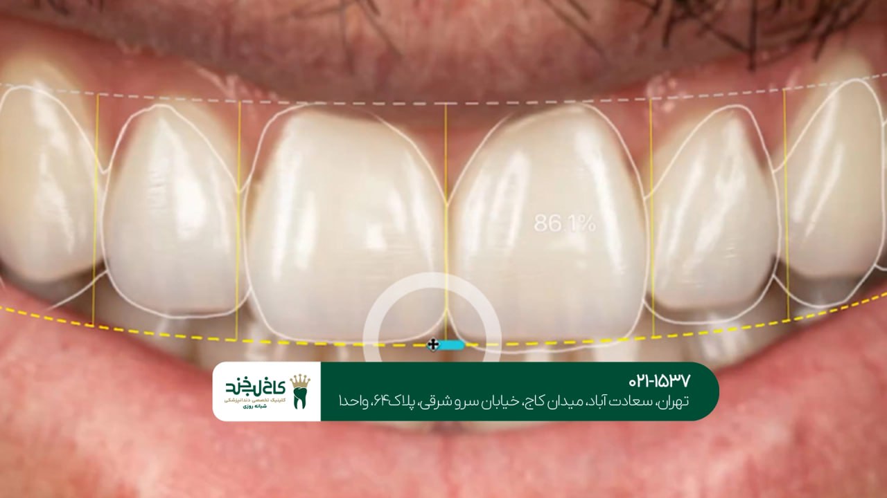 کلینیک تخصصی اصلاح طرح لبخند کلینیک تخصصی اصلاح طرح لبخند