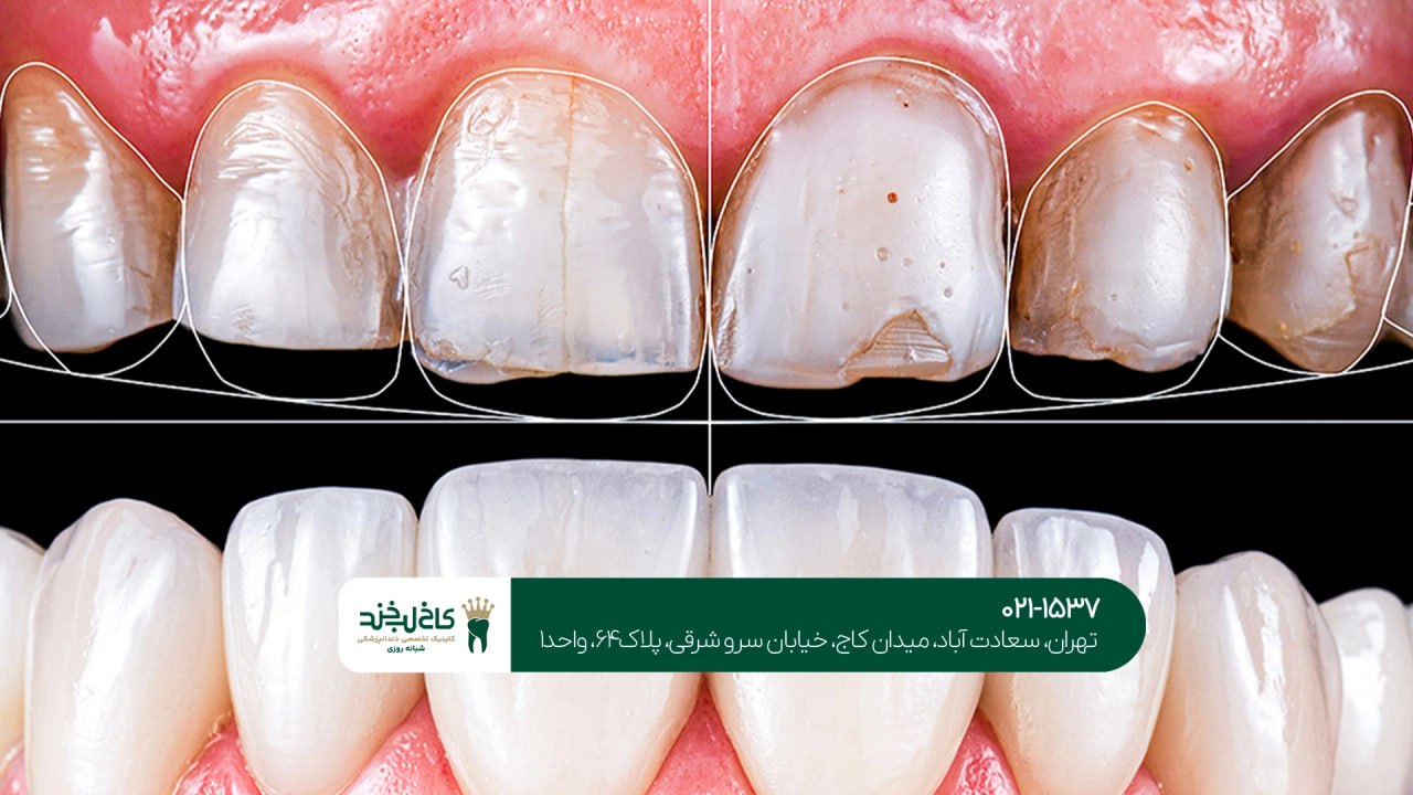 کلینیک تخصصی اصلاح طرح لبخند کلینیک تخصصی اصلاح طرح لبخند