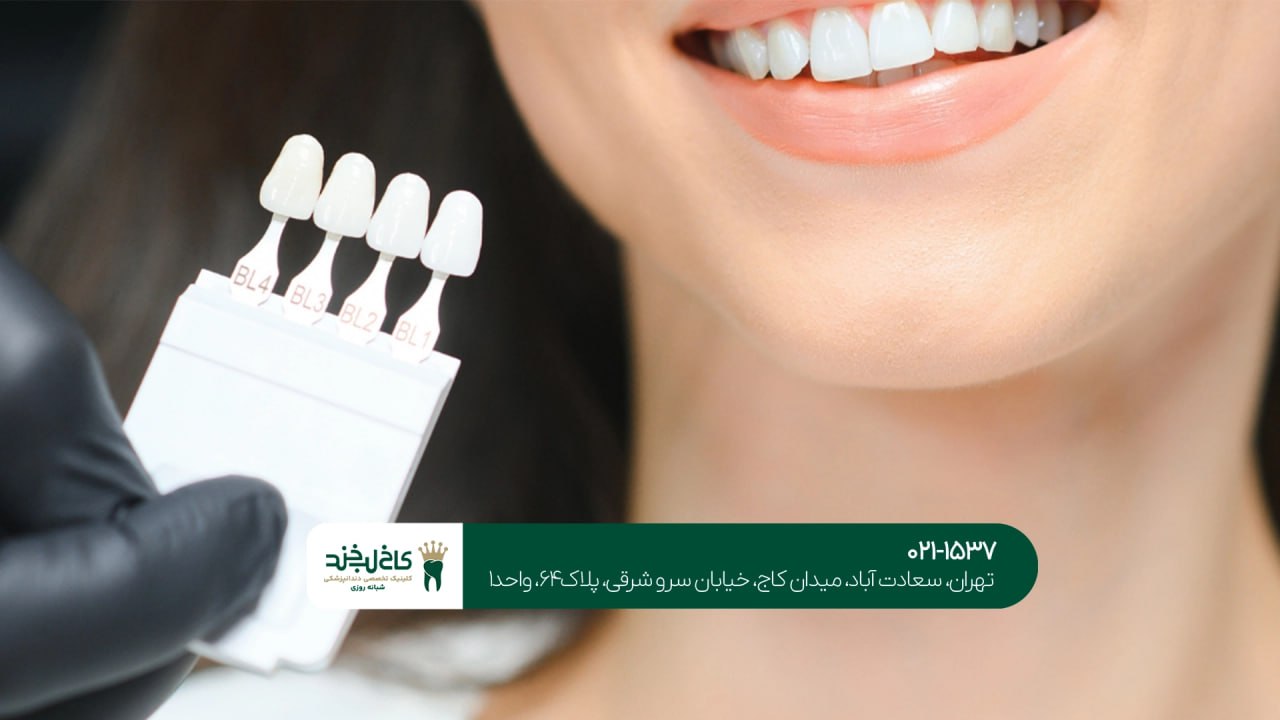 لمینت اقساطی در نیاوران لمینت اقساطی در نیاوران