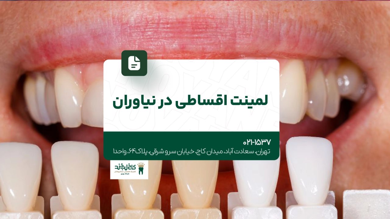 لمینت اقساطی در نیاوران لمینت اقساطی در نیاوران