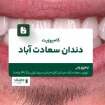 کامپوزیت دندان سعادت آباد