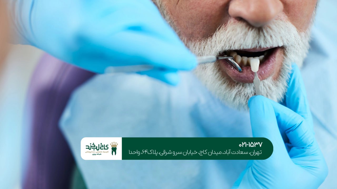 دندانپزشکی اقساطی برای بازنشستگان دندانپزشکی اقساطی برای بازنشستگان