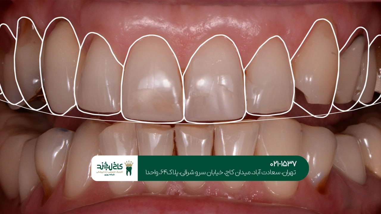 طرح لبخند اقساطی طرح لبخند اقساطی