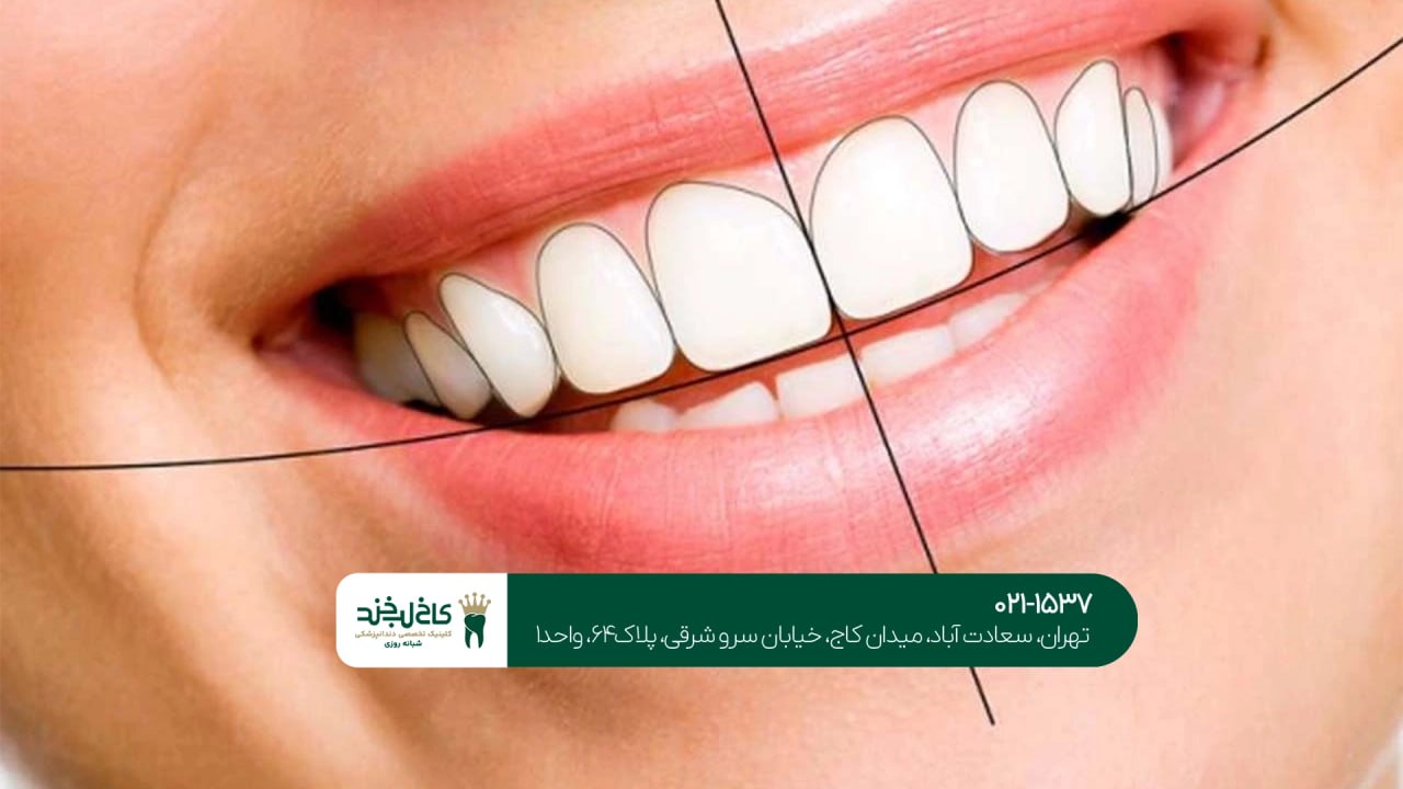 طرح لبخند اقساطی طرح لبخند اقساطی