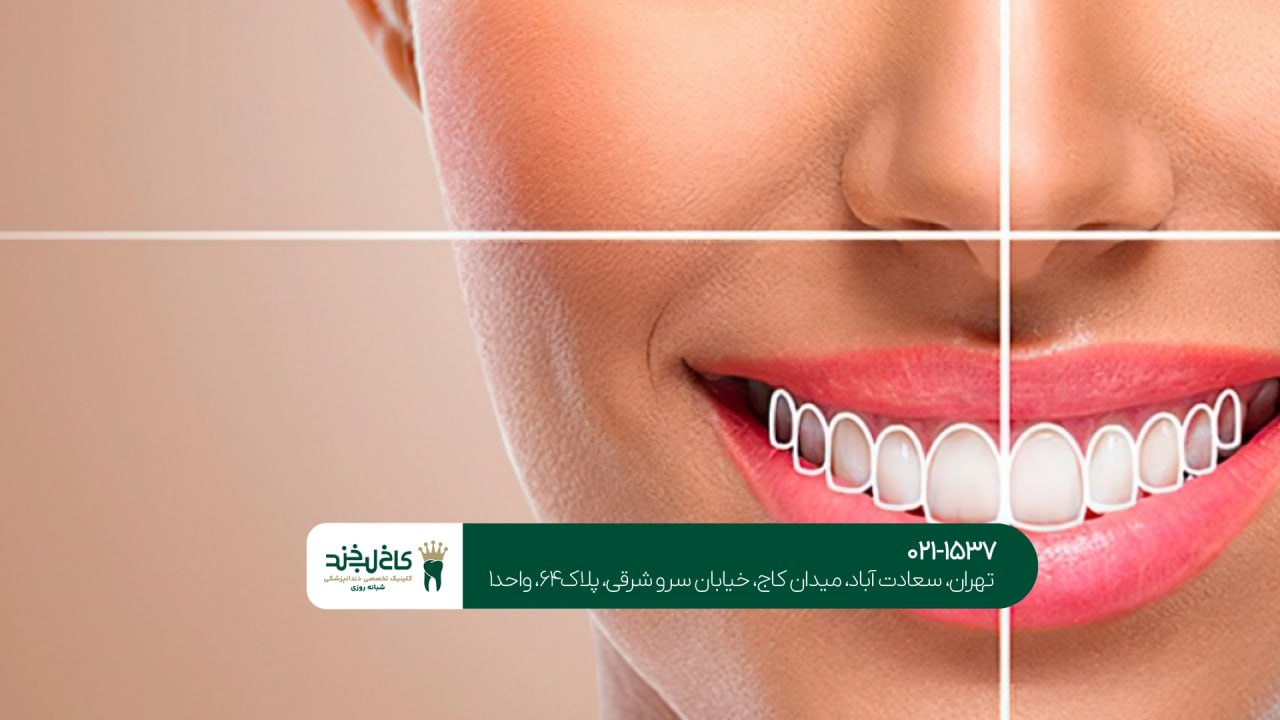 طرح لبخند اقساطی طرح لبخند اقساطی