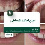 طرح لبخند اقساطی