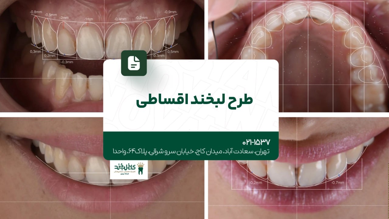 طرح لبخند اقساطی طرح لبخند اقساطی