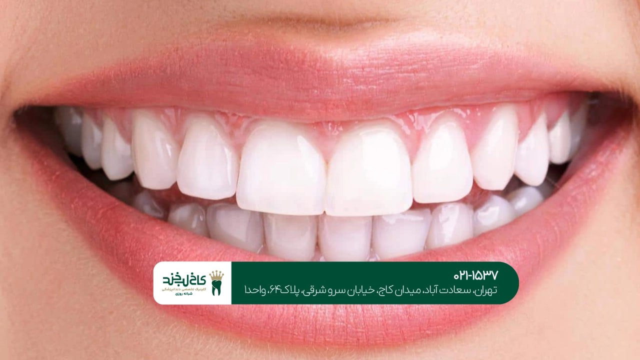 بهترین دندانپزشک زیبایی در شمال تهران بهترین دندانپزشک زیبایی در شمال تهران