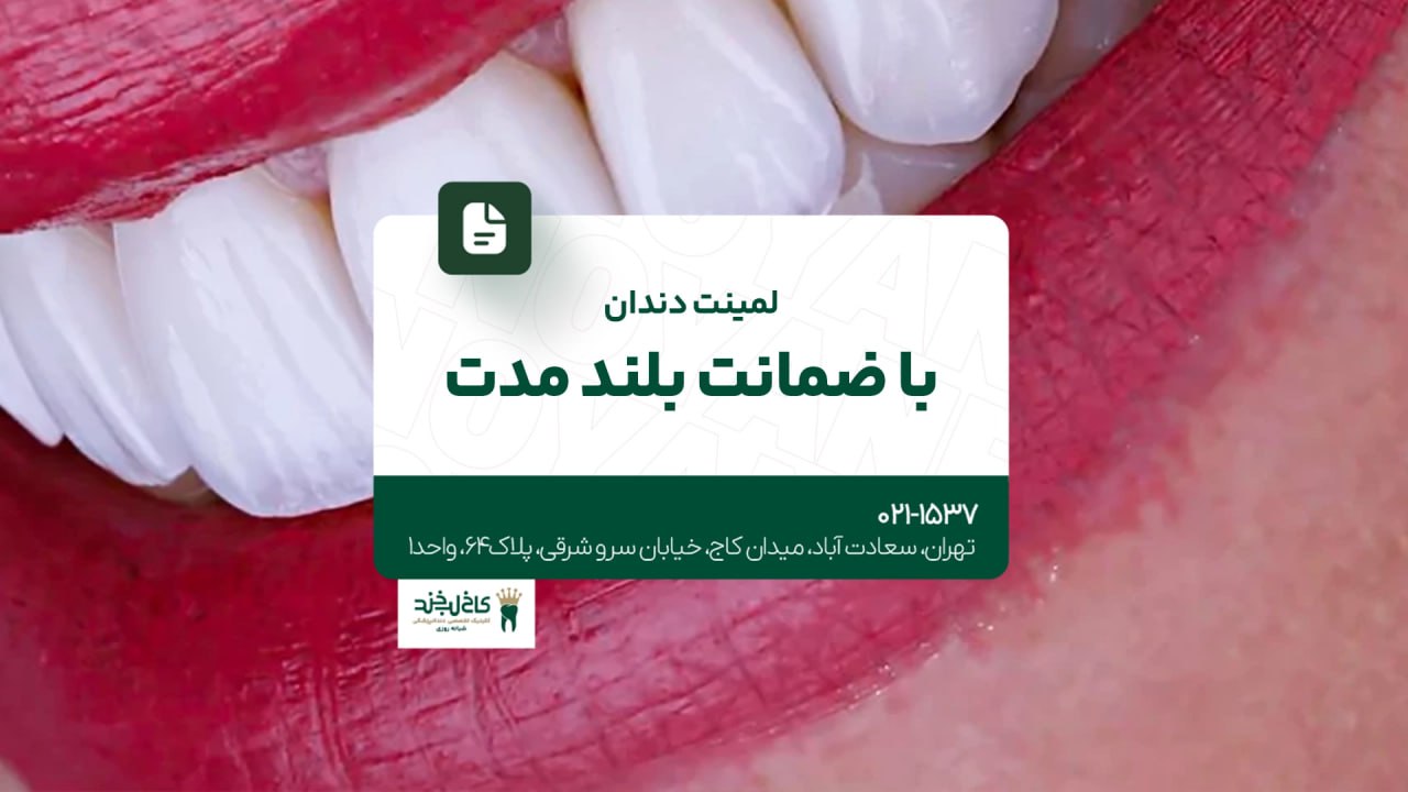 لمینت دندان با ضمانت بلندمدت لمینت دندان با ضمانت بلندمدت