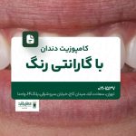 کامپوزیت دندان با گارانتی رنگ
