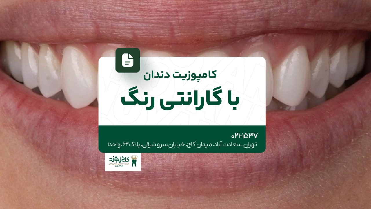 کامپوزیت دندان با گارانتی رنگ کامپوزیت دندان با گارانتی رنگ