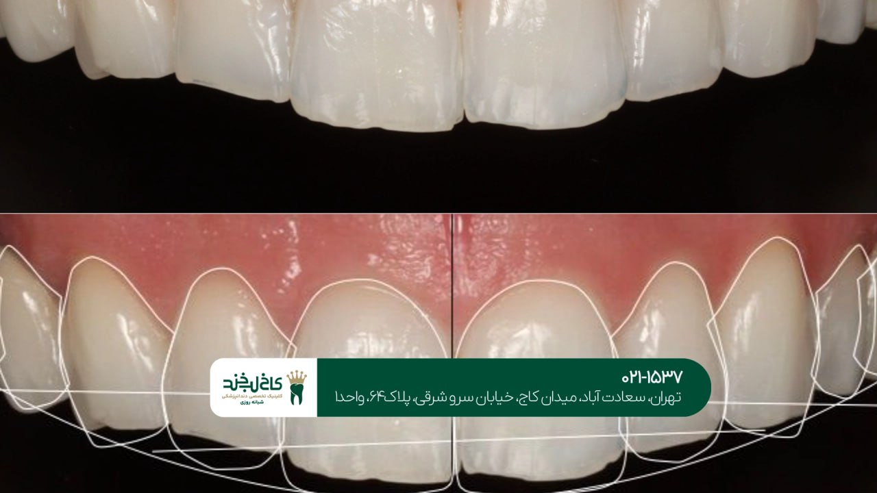 اصلاح لبخند طبیعی در کلینیک تخصصی اصلاح لبخند طبیعی در کلینیک تخصصی