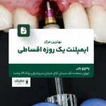 بهترین مرکز ایمپلنت یک روزه اقساطی