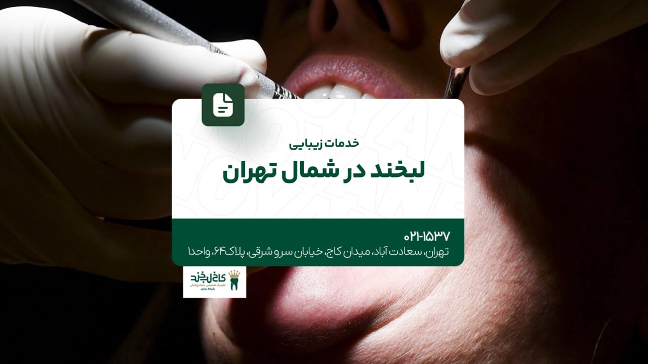 خدمات زیبایی لبخند در شمال تهران خدمات زیبایی لبخند در شمال تهران