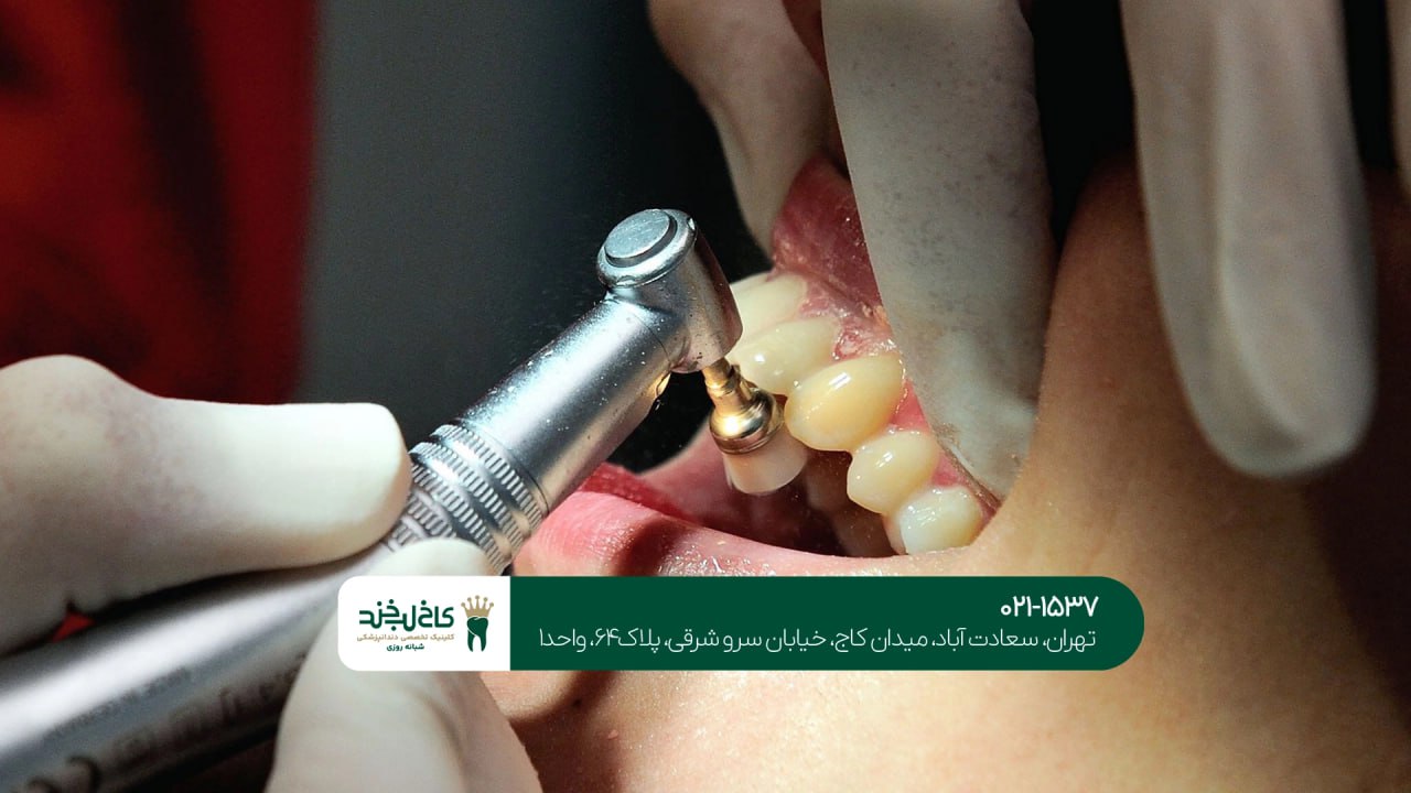 خدمات زیبایی لبخند در شمال تهران خدمات زیبایی لبخند در شمال تهران