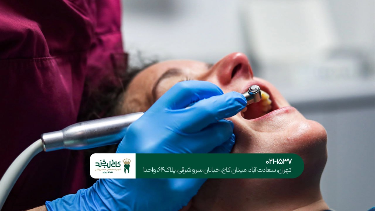 خدمات زیبایی لبخند در شمال تهران خدمات زیبایی لبخند در شمال تهران