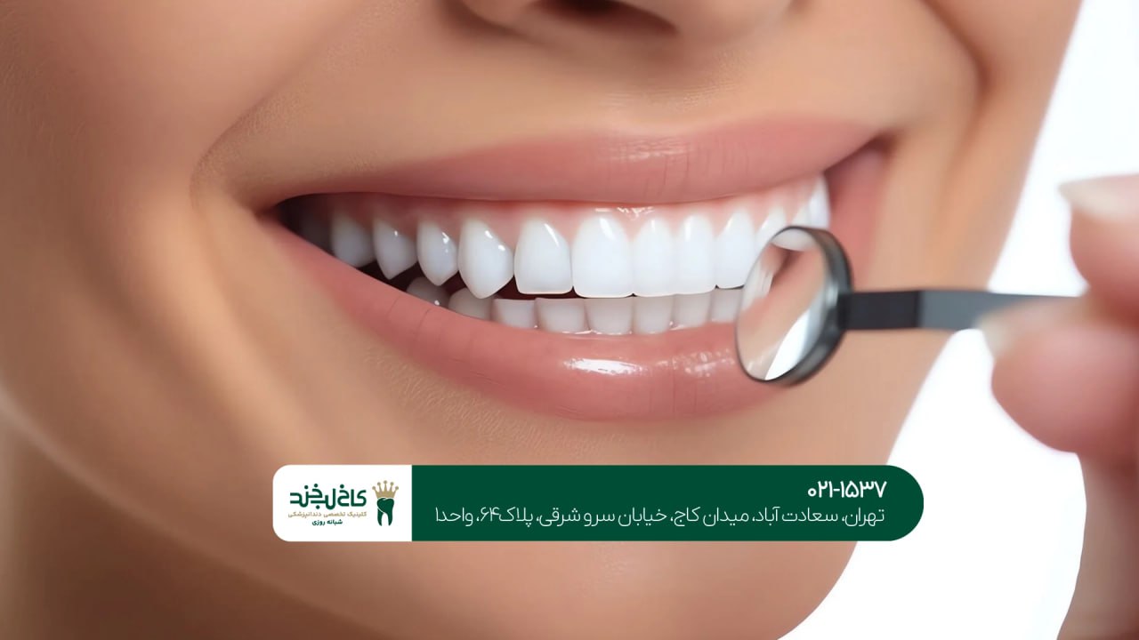 دندانپزشکی زیبایی و تخصصی در تهران دندانپزشکی زیبایی و تخصصی در تهران