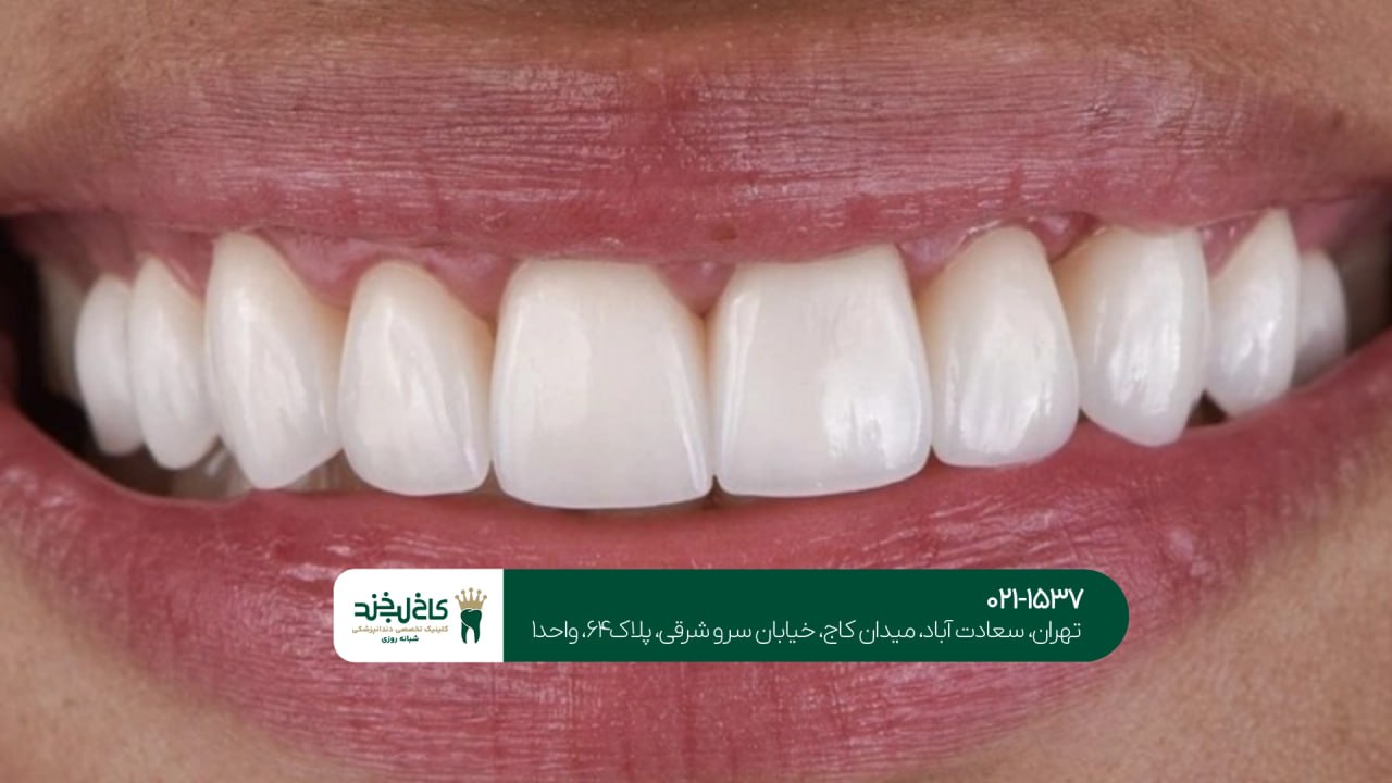 دندانپزشکی زیبایی و تخصصی در تهران دندانپزشکی زیبایی و تخصصی در تهران